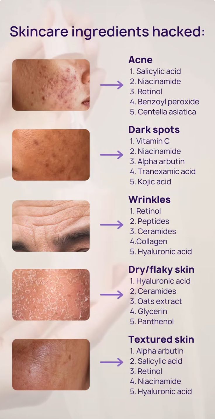 Advanced Niacinamide Serum for Even & Glowing Skin