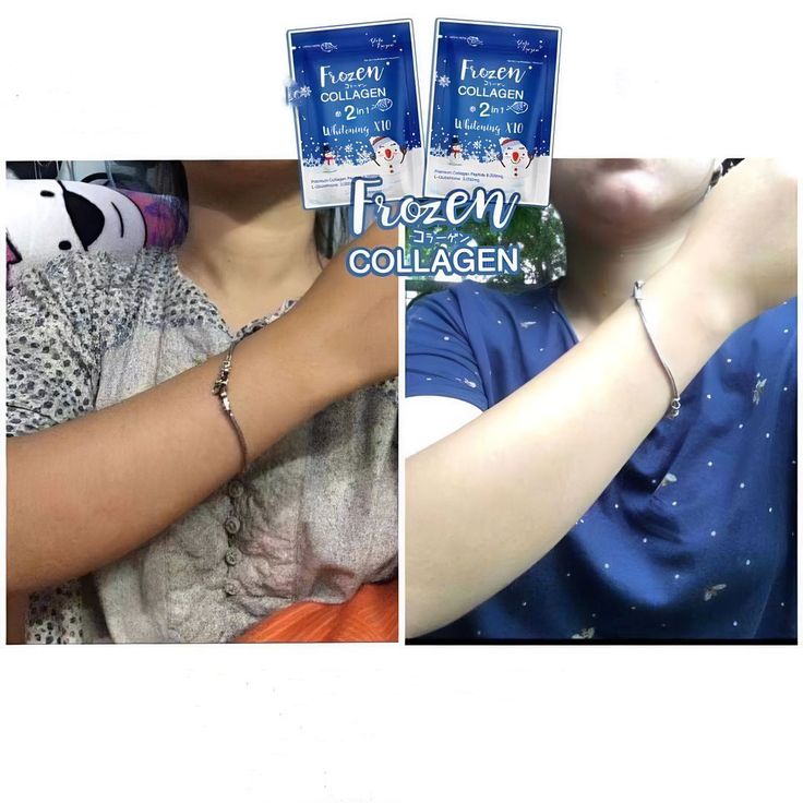 Whitening & Brightening Capsules | Skin Radiance Formula